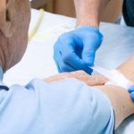 Screening gratuito per l’Epatite C nei centri prelievo ASST Nord Milano